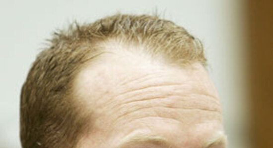 Mark McGwire's Pound of Flesh