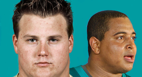 The NFL’s Bully Problem 