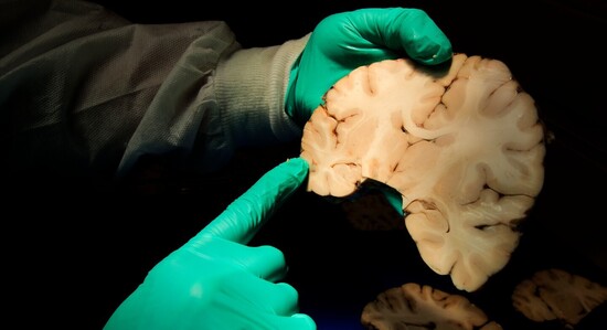 Will the NFL Survive the New Science of Brain Damage?